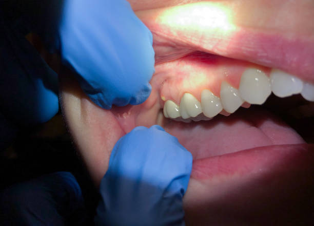 Best Same-Day Emergency Dental Services in Lakewood Clu, MI