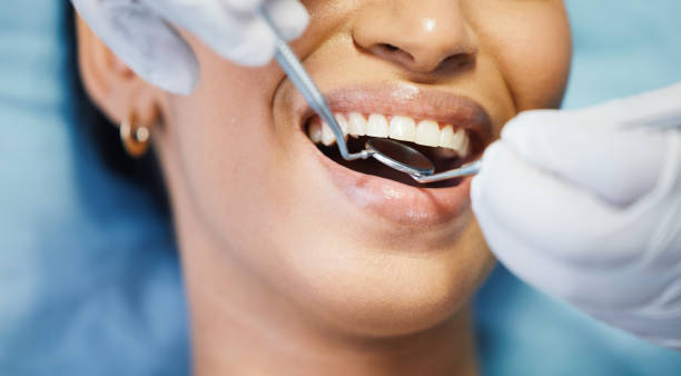 Best Pediatric Emergency Dentist in Lakewood Clu, MI